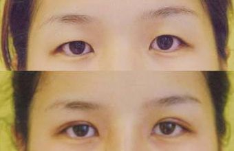 大慶微整形醫(yī)院哪家好？頂級專家為您解讀微整形醫(yī)院選擇指南！