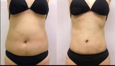 太原哪家醫(yī)院眼袋整形好？優(yōu)質(zhì)專家推薦