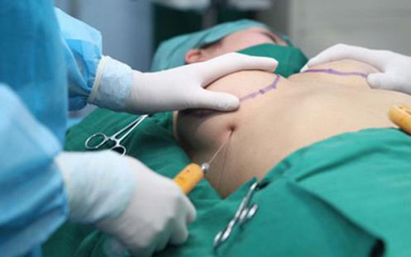 2023天津背部吸脂瘦身醫(yī)生排行十強(qiáng)(楊珈寧、唐婷婷、張鶴明實(shí)力口碑并存)