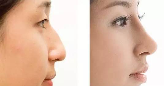 2023深圳瘦大腿吸脂術(shù)醫(yī)生榜單top10強(qiáng)(羅雄鵬、江虹、何安平這些醫(yī)生值得推薦)