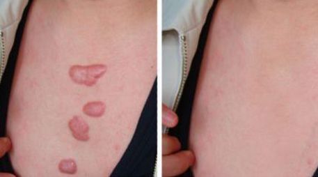 鄭州市哪家美容醫(yī)院好？?jī)?yōu)質(zhì)專業(yè)醫(yī)療服務(wù)等你來咨詢！