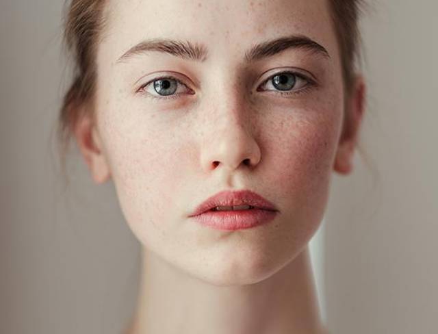 武漢嚴玲玲做雙眼皮效果如何？專家?guī)私馐中g技術和價格