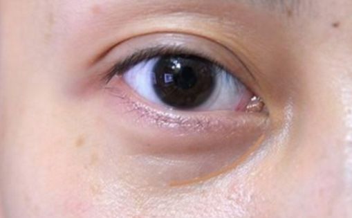 邯鄲哪家醫(yī)院做私密整形好？解析當(dāng)代女性美容訴求