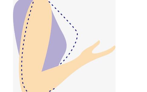 鄭州雙眼皮手術(shù)：張永濤、魯亞?wèn)|、張芳等名醫(yī)排名公開(kāi)