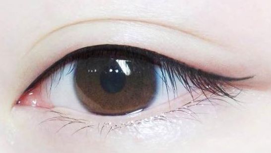 【長治哪家醫(yī)院祛痣效果好？專家推薦讓你放心選擇】