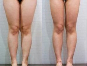 南京眼皮松弛醫(yī)院排名及口碑調(diào)查：哪家醫(yī)院是患者首選？