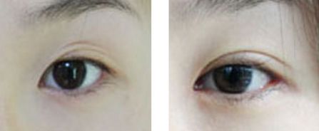 汕頭市整形醫(yī)院有哪些？哪家整形醫(yī)院在汕頭市口碑好？