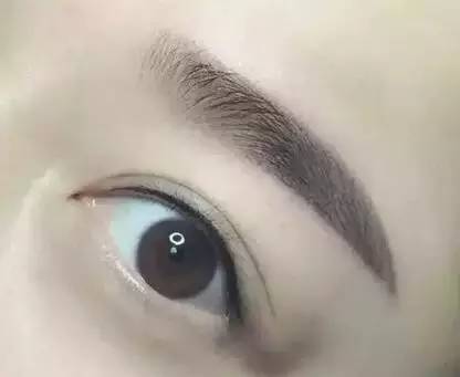 佰華利董萍的面部脂肪填充經(jīng)驗，展現(xiàn)自然少女感