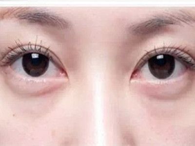 寧波祛斑哪家醫(yī)院好？精選寧波祛斑專業(yè)醫(yī)院推薦！