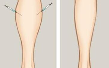 上海第九人民醫(yī)院美容外科專(zhuān)家介紹：劉菲、蘇薇潔領(lǐng)軍，醫(yī)術(shù)出眾！