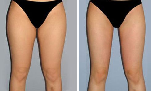 重慶美萊整形美容醫(yī)院口碑如何？醫(yī)生名單和特色項目都有什么？