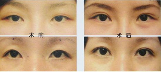 揭秘佛山哪家整形醫(yī)院吸脂好？導(dǎo)醫(yī)全解析、患者口碑高，信賴度高！