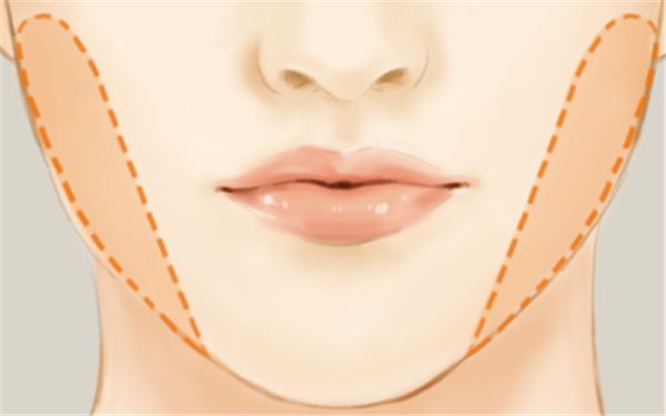 寧波海曙美萊醫(yī)療美容整形醫(yī)院醫(yī)生技術(shù)靠譜嗎？手術(shù)項目有哪些呢？