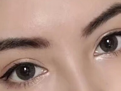 2023成都面部脂肪填充川字紋醫(yī)生排行前十位(趙術(shù)、李文明、蔣代為技術(shù)實力優(yōu)異)