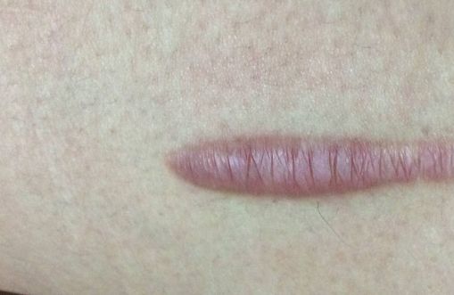 南京有哪些值得推薦的較正規(guī)美容醫(yī)院？