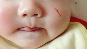 【連云港哪家激光祛斑好，推薦最受用戶歡迎的祛斑機(jī)構(gòu)】