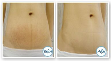 不得不佩服武漢蜜司楊蓉的雙眼皮，簡(jiǎn)直完美！讓我們來(lái)了解一下醫(yī)院簡(jiǎn)介、看看一些案例以及價(jià)格的超全信息。