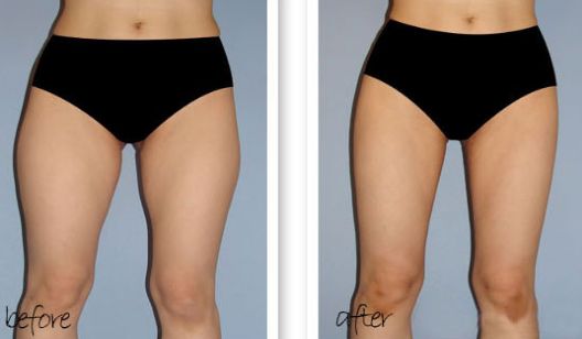 南京哪家醫(yī)院除雀斑好？醫(yī)院雀斑治療排名及效果對比！