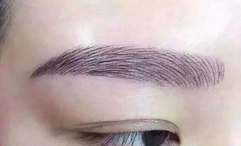 2023年脂肪填充領域的醫(yī)師鄧東偉與趙尤軍，自體脂肪移植技術的新潮流