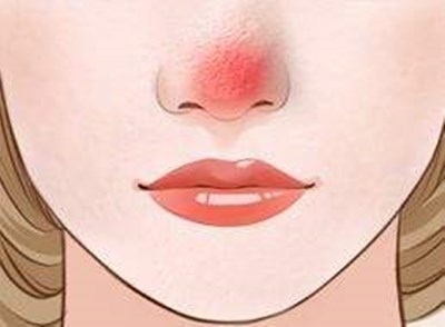 上海九院哪位醫(yī)生做雙眼皮技術(shù)好？價(jià)格如何？附帶成功案例分析