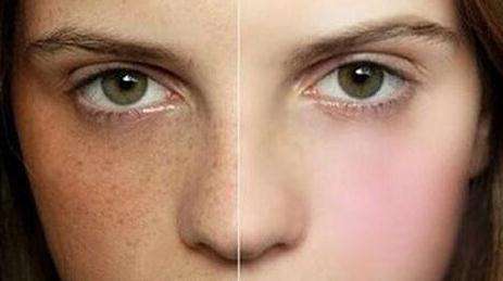 2023青島隆鼻修復(fù)醫(yī)生在榜名單TOP10(于文成、單繼華、任紀(jì)禎哪個技術(shù)OK？)