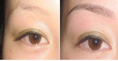 湖北哪家醫(yī)院治療團(tuán)結(jié)口好呢？