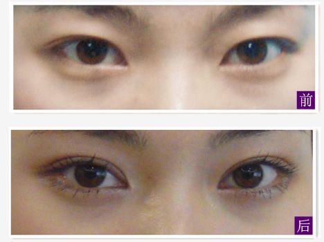 求推薦南寧哪家整形醫(yī)院好？讓你輕松找到靠譜的整容醫(yī)院