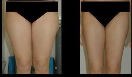 南京做拉皮哪家醫(yī)院好？排名靠前的南京做拉皮醫(yī)院有哪些？