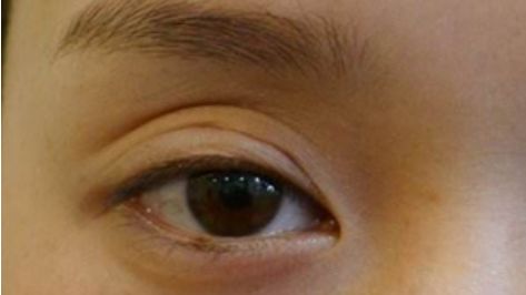 悅美整形醫(yī)院是否是合規(guī)醫(yī)療機構(gòu)？資質(zhì)概述與名醫(yī)坐診引薦獲取？