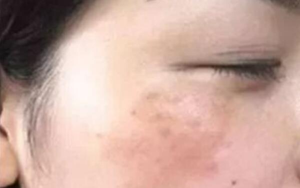 武漢協(xié)和醫(yī)院醫(yī)生鐘愛梅，精湛鼻子整形案例揭秘