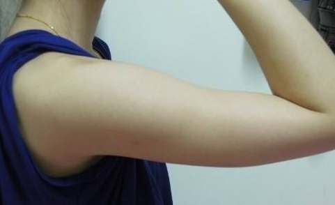 趙寅局拉皮：口碑何如？經歷、擅長和用戶反饋來說話！