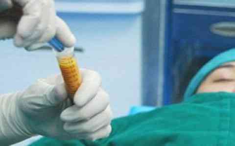 張嬌嬌鼻部整形效果驚艷，愛(ài)思特知名醫(yī)生分享案例美圖，讓我心動(dòng)！