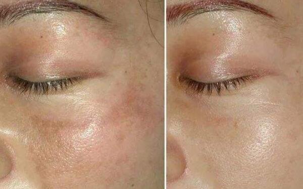 廣州領(lǐng)銜！全新發(fā)布隆鼻專家排行榜！盤點(diǎn)醫(yī)生資料！