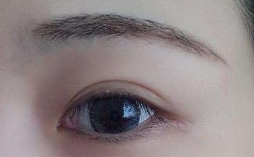 【2023年最新】鄭州哪家雙眼皮醫(yī)院口碑好、技術(shù)高？！