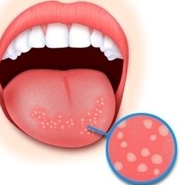 2023重慶川字紋填充自體脂肪口碑榜醫(yī)生(李正形、鄧誠、王琪斌誰個更出色！)