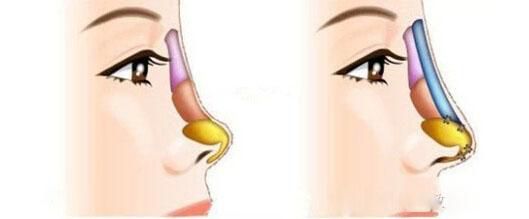 全國哪家醫(yī)院祛斑好？10家值得信賴的專業(yè)醫(yī)院推薦