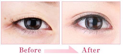 2023新鄉(xiāng)玻尿酸去除黑眼圈權(quán)威醫(yī)生評分TOP10(魏作明、井素芳、魏作明實力口碑沒一個差的)