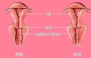 長沙靠譜矯正醫(yī)院哪家好？解答你所有的疑慮！