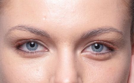 深圳哪家醫(yī)院的埋線減肥效果最好？