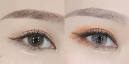 2023杭州面部填充眼紋醫(yī)生前10位上榜名單(馬瑞宣、王正云、司婷婷領(lǐng)銜榜首~)