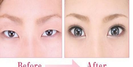 貴陽(yáng)鼻部整形醫(yī)院哪家好？綜合排名及用戶評(píng)價(jià)一覽