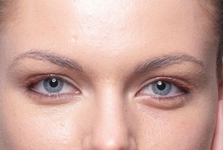 成都有哪些專業(yè)的祛斑祛痘印機構值得推薦？