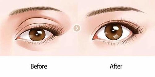 許揚濱隆胸術的效果評價及相關費用一覽