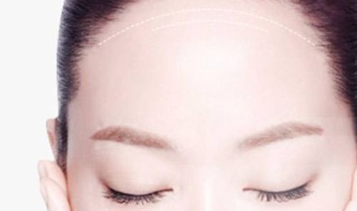 南京做修復(fù)雙眼皮哪家好？解析南京修復(fù)雙眼皮的最佳選擇