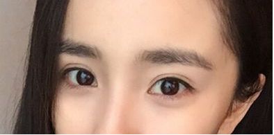 珠海市祛斑好的醫(yī)院哪家靠譜？