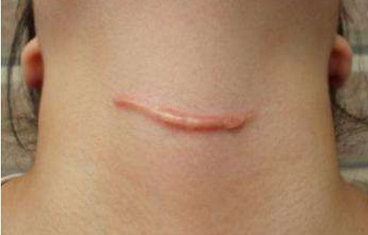 衡陽去痘坑哪家醫(yī)院好？-衡陽市專業(yè)祛痘修復醫(yī)院排行榜