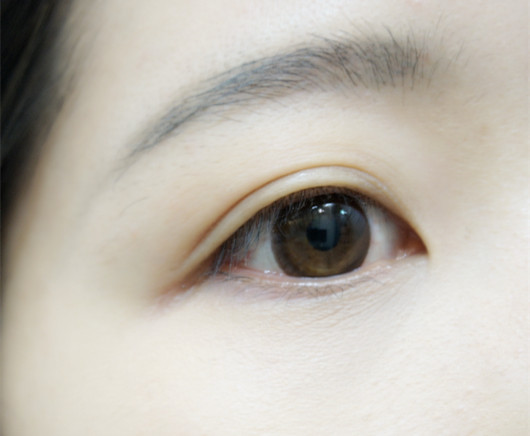 2023承德熊貓針去川字紋口碑排名前十強醫(yī)生(堵頂云、魏國祥、魏國祥個個都是實力派代表！)