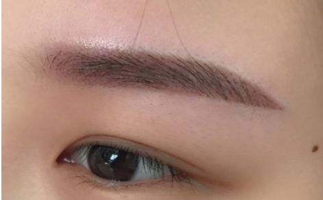 杭州哪家醫(yī)院做隆胸效果好？