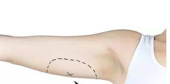 南京去除黃褐斑醫(yī)院排名及口碑，哪家值得信賴？