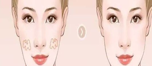 南京哪家醫(yī)院的小陰唇整形效果好？